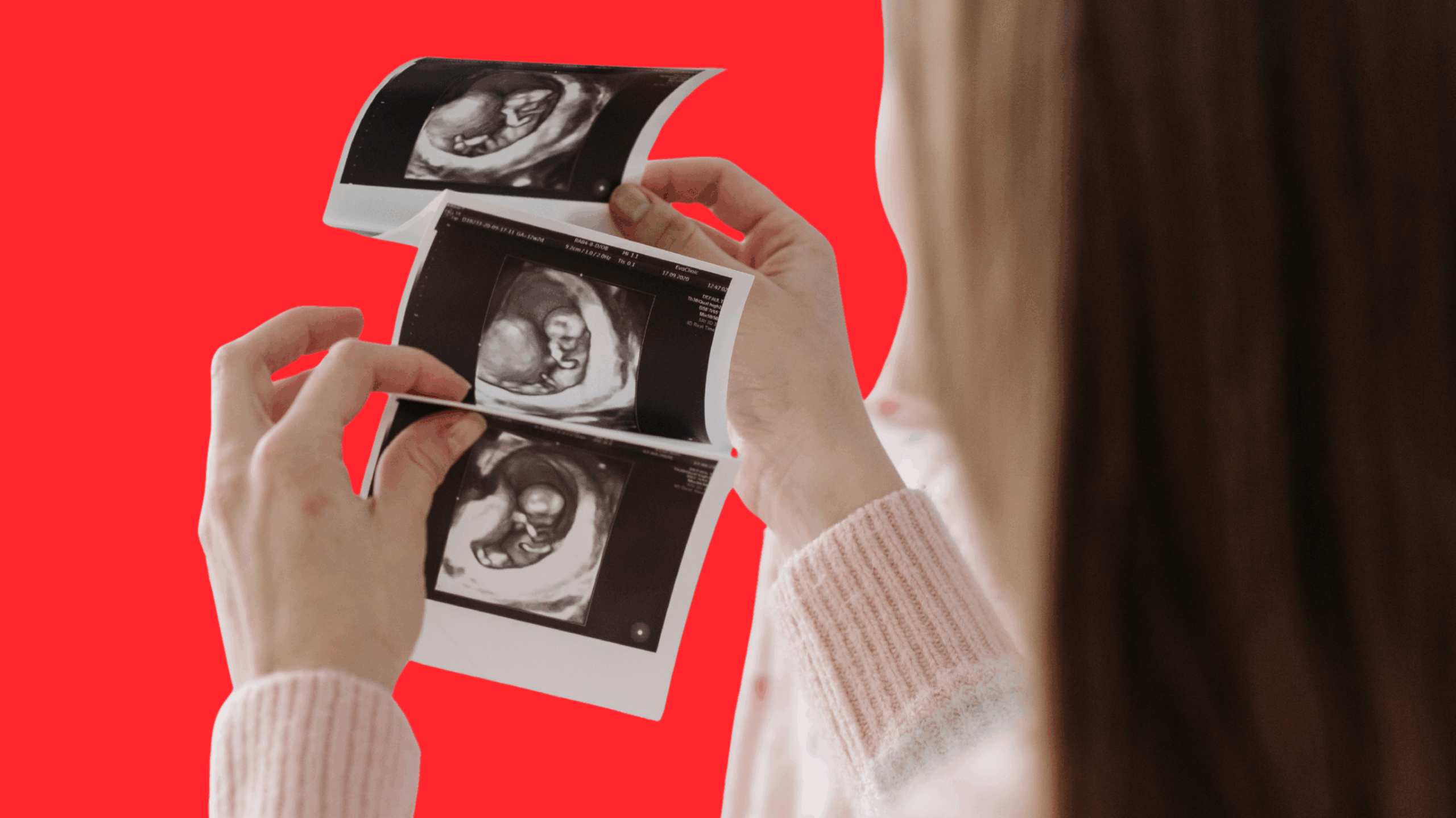 První like ještě před narozením. Jak rodiče tvoří dětem digitální stopu od ultrazvuku?